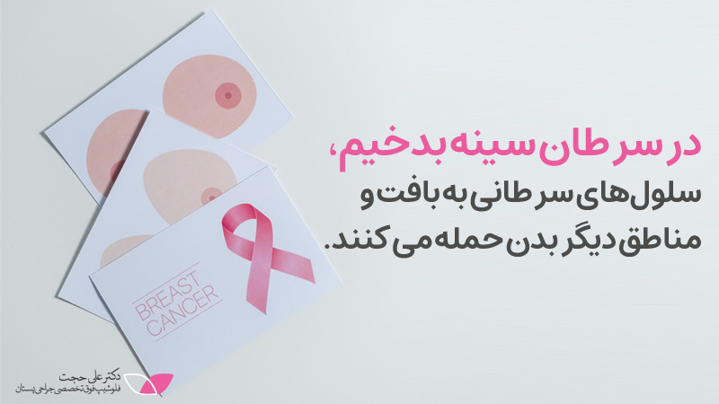 سرطان پستان بدخیم | درمان سرطان سينه بدخيم