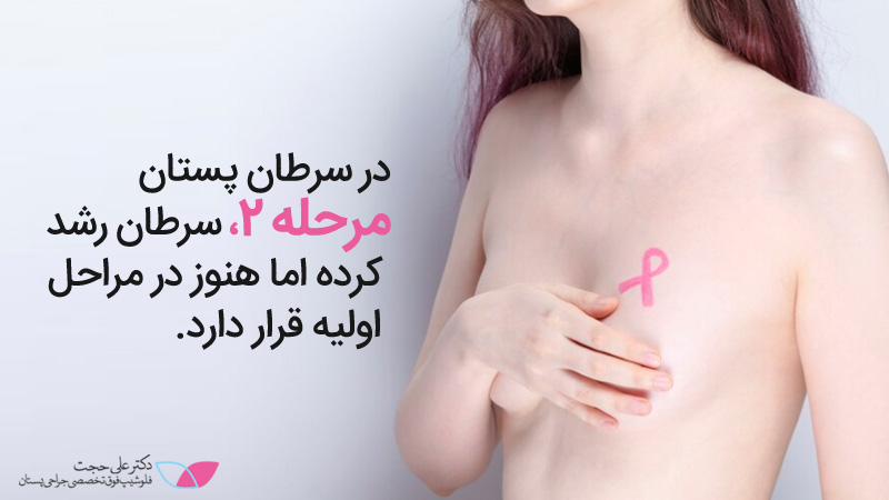 سرطان سینه مرحله ۲