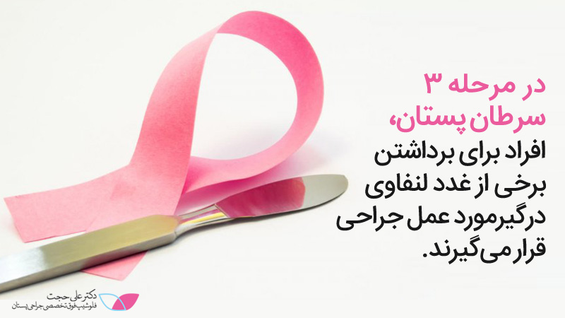 سرطان پستان مرحله 3