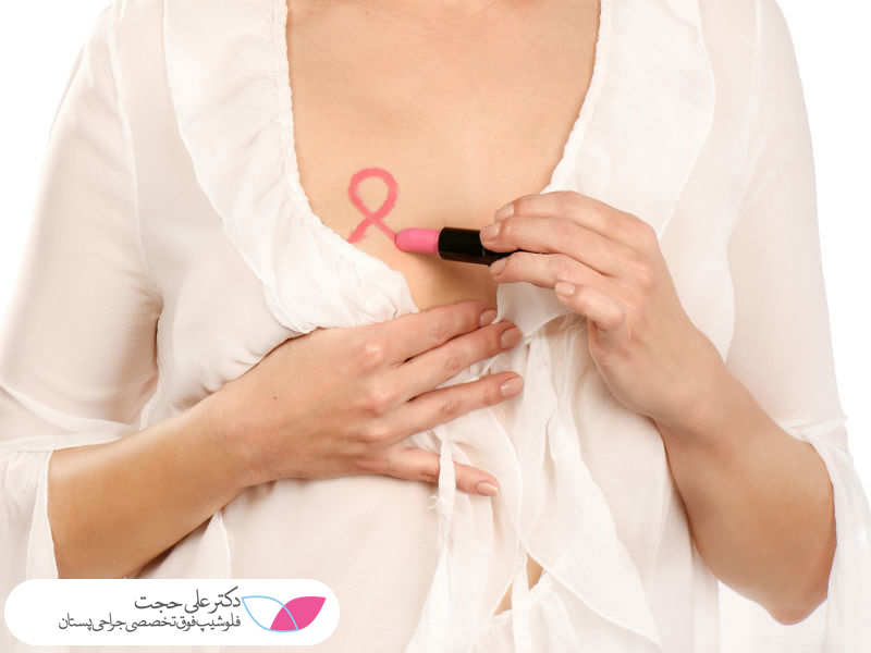 سرطان سینه زنان 