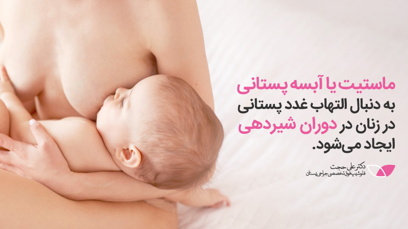 آبسه پستان با ماستیت