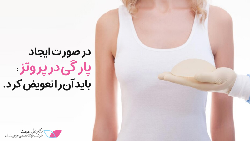 احتمال پاره شدن پروتزسینه