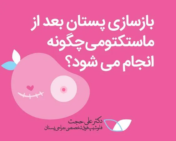 بازسازی پستان بعد از ماستکتومی