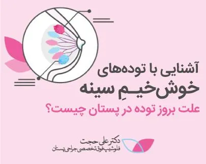 توده خوش خیم سینه