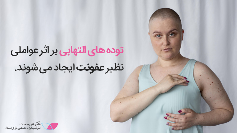 توده های التهابی سینه | سرطان سينه چه علائمي دارد