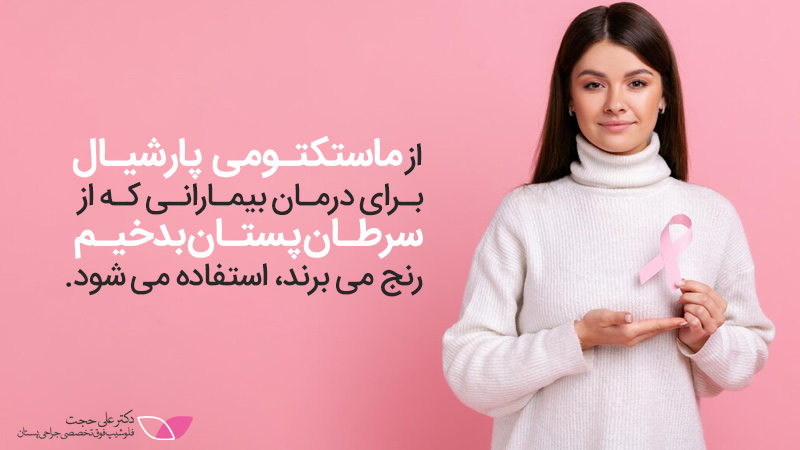 روش ماستکتومی پارشیال