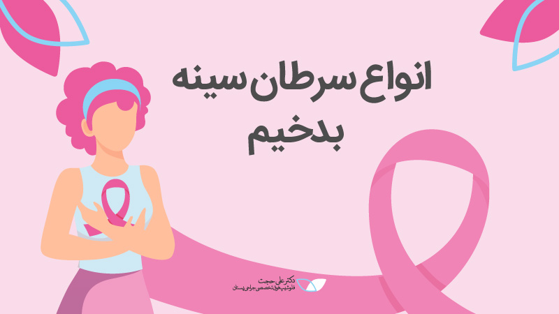 سرطان سینه بدخیم