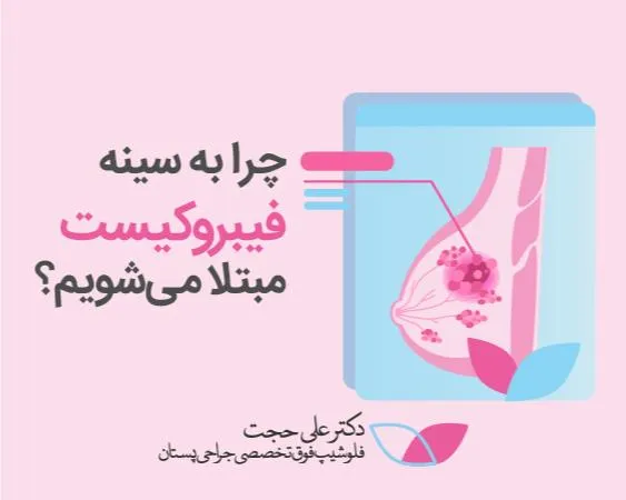 سینه فیبروکیستیک