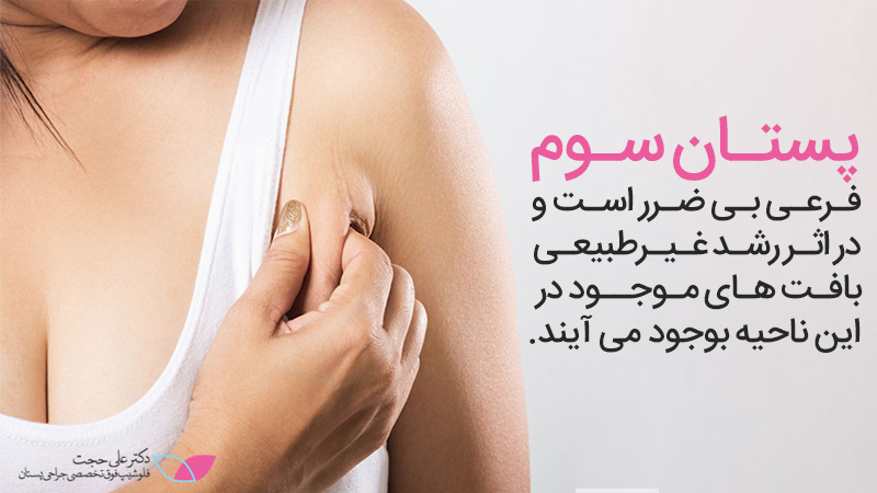 علت رشد سینه سوم