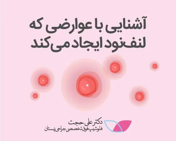 لنف نود چیست