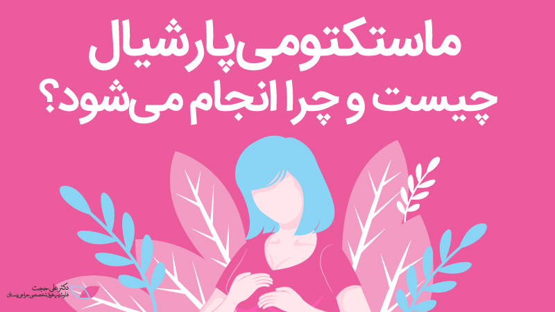 ماستکتومی پارشیال چیست