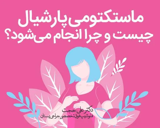 ماستکتومی پارشیال