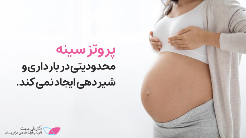 پروتز سینه و بارداری 