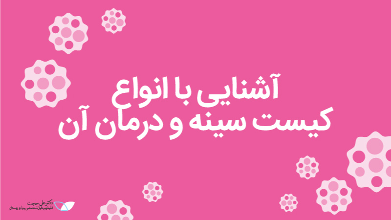 كيست سينه چیست