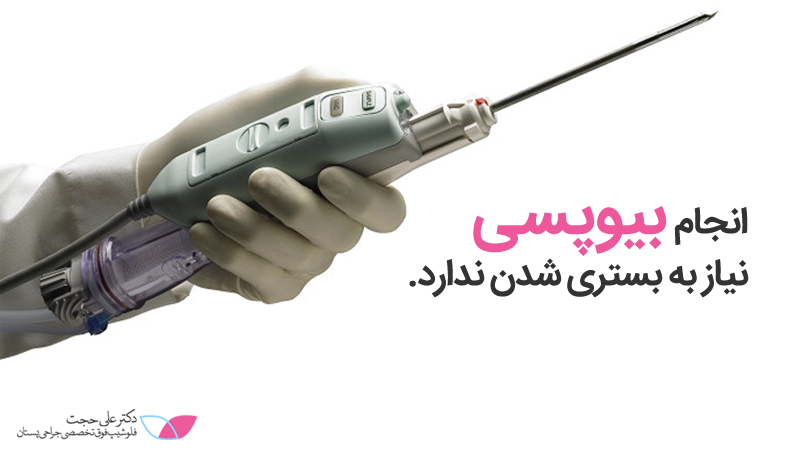 انجام بیوپسی سینه | بیوپسی چیست