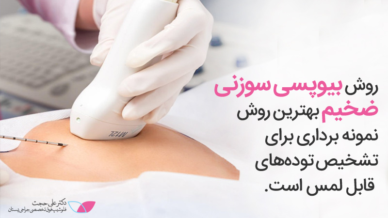 نمونه برداری سوزنی سینه | بیوپسی سینه