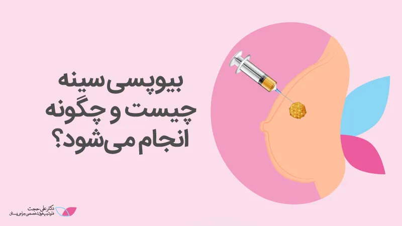 بیوپسی سینه چیست بیوپسی سینه چیست