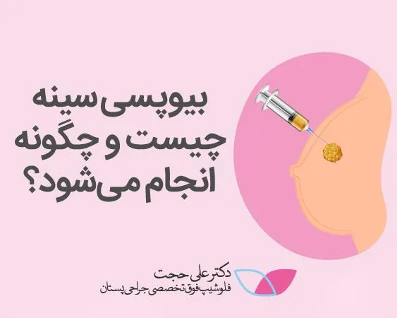 بیوپسی سینه