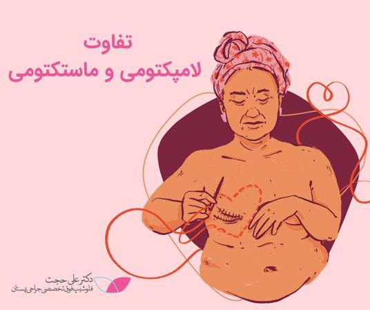 تفاوت لامپکتومی و ماستکتومی