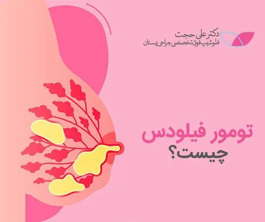 تومور فیلودس