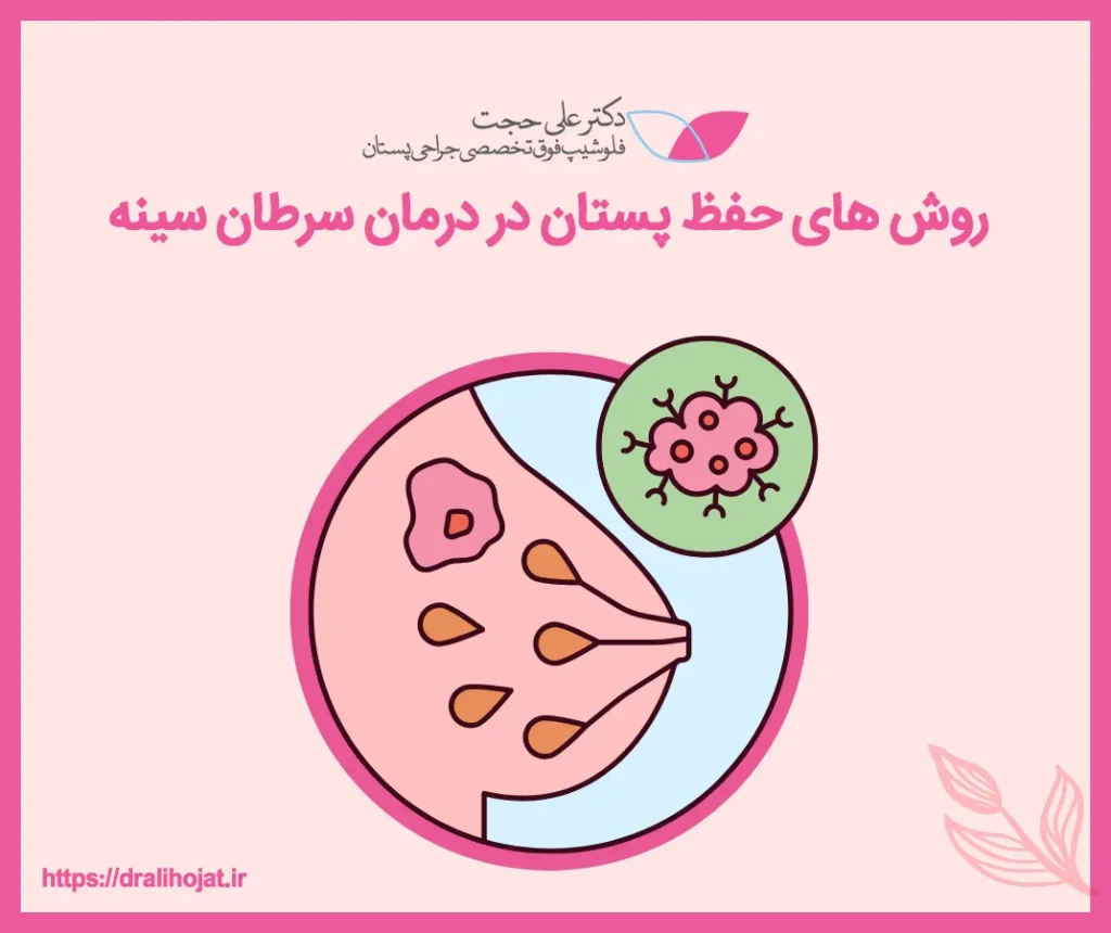 جراحی حفظ پستان