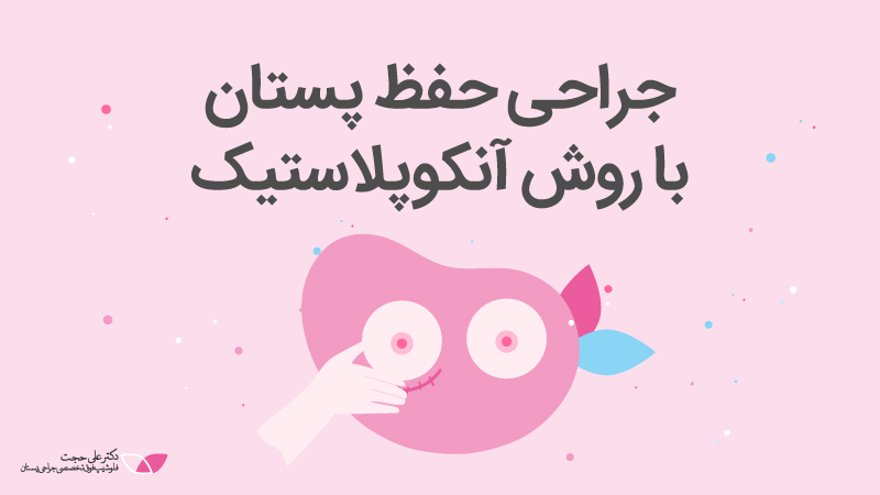 جراحی حفظ پستان با روش آنکوپلاستیک