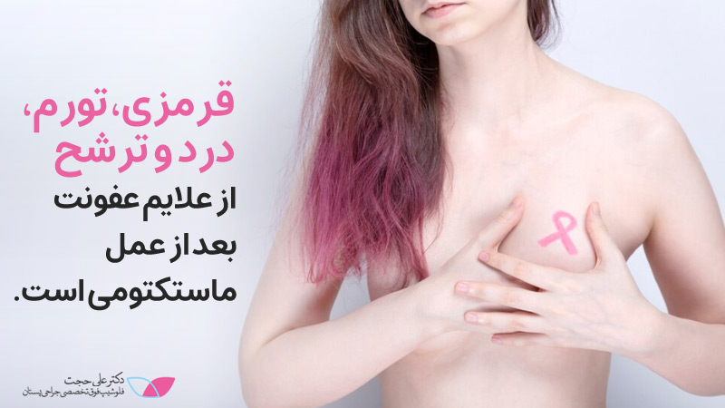 عوارض ماستکتومی | درد دست بعد از ماستکتومی
