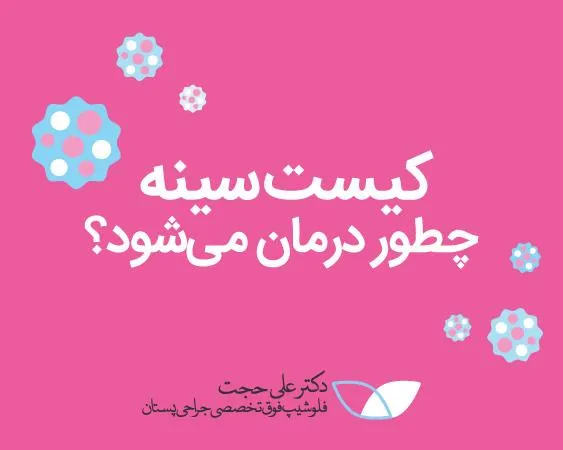 درمان کیست سینه