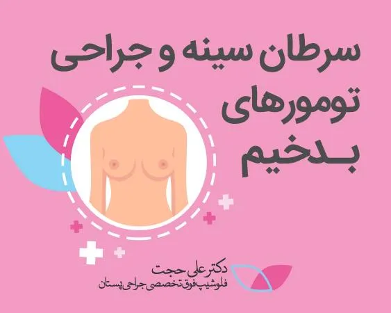 سرطان بدخیم سینه