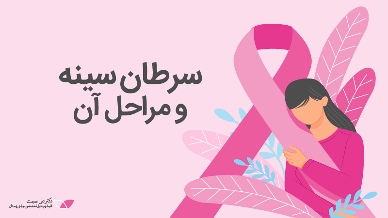 سرطان سینه و مراحل آن | مراحل سرطان سینه