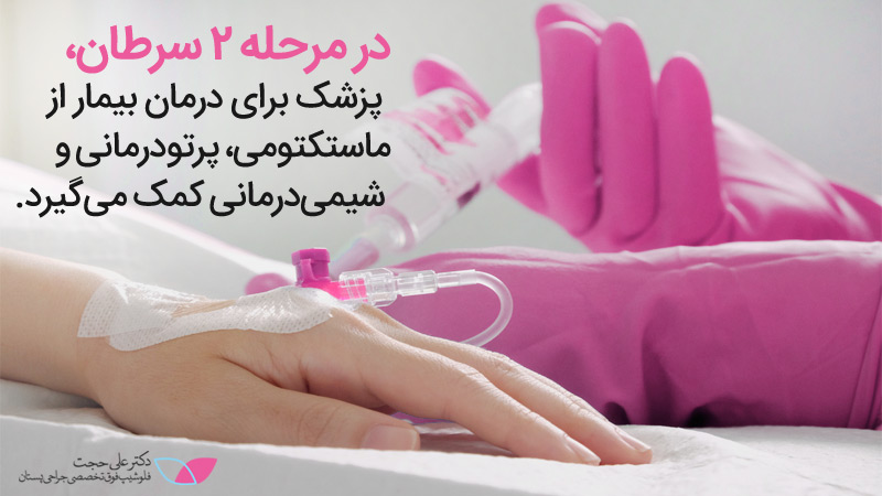 سرطان پستان مرحله۲ | مراحل سرطان سینه