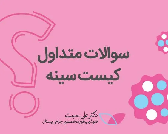 سوالات متداول کیست سینه