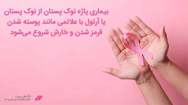 علائم سرطان سینه غیر تهاجمی علائم سرطان سینه غیر تهاجمی