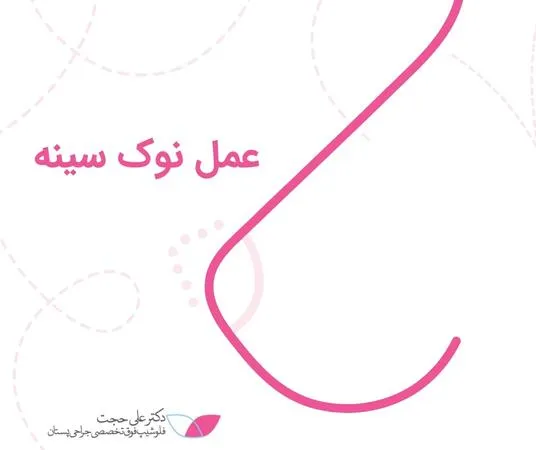 عمل نوک سینه