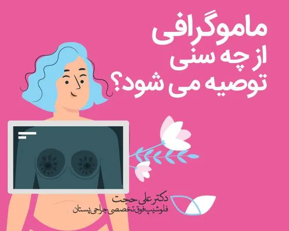 ماموگرافی