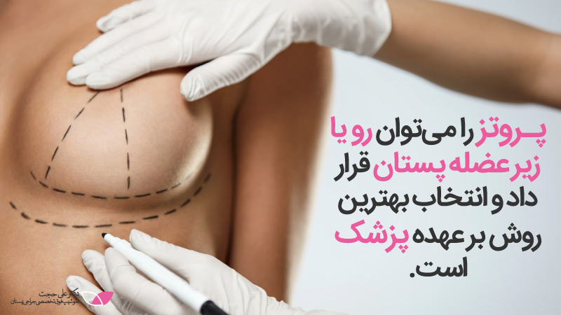 هزینه عمل زيبايي سينه زنان | هزينه عمل سينه زنان