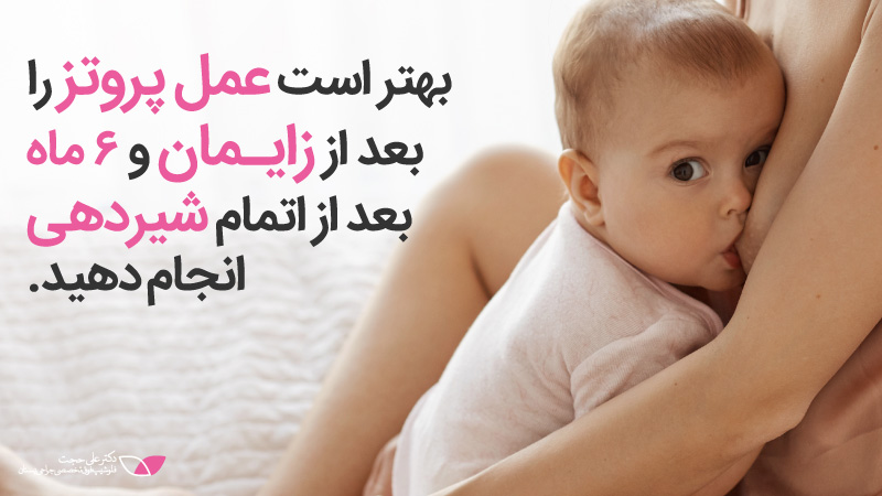 پروتز سینه بعد از زایمان | هزینه جراحی سینه