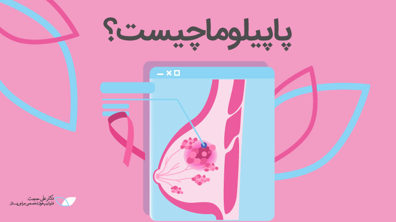 پاپیلوما چیست