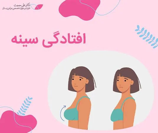 افتادگی سینه