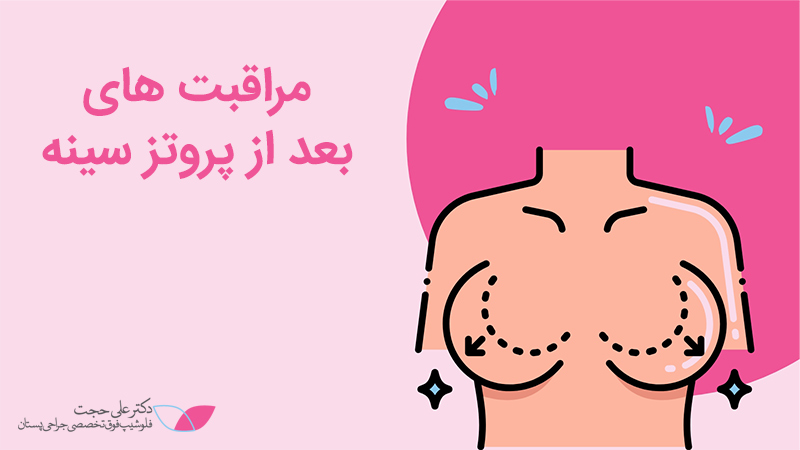 مراقبت بعد از پروتز سینه