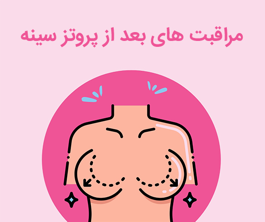 مراقبت های بعد از پروتز سینه