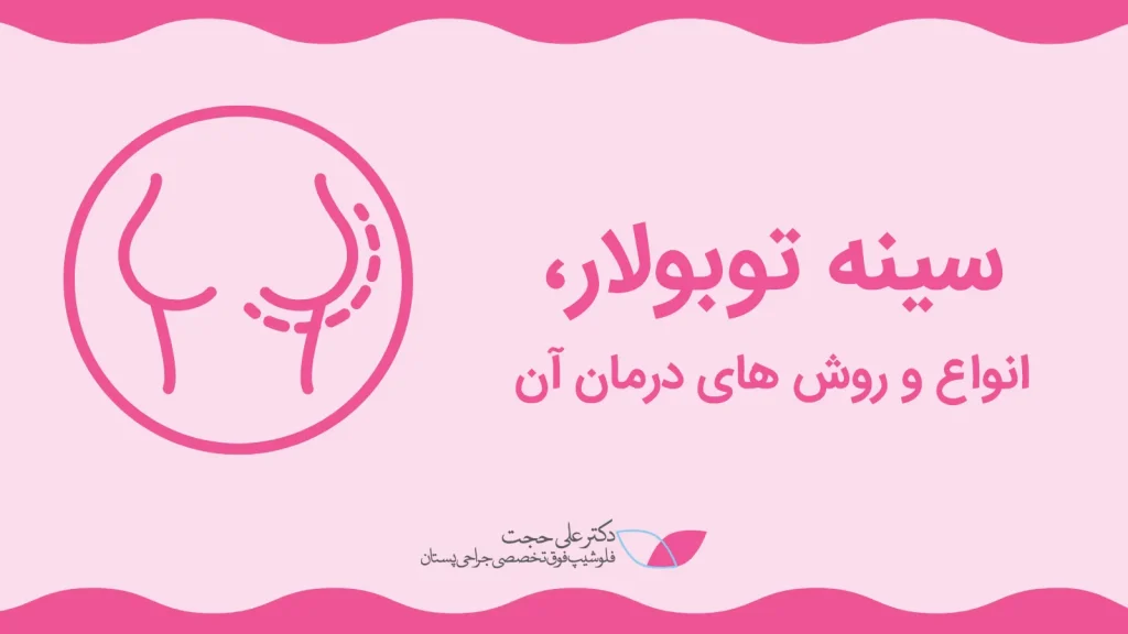 سینه توبروس
