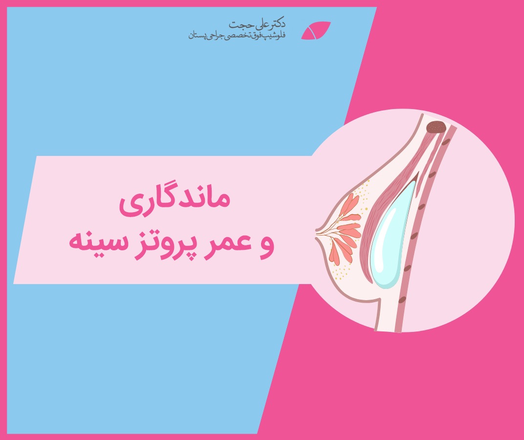 ماندگاری پروتز سینه