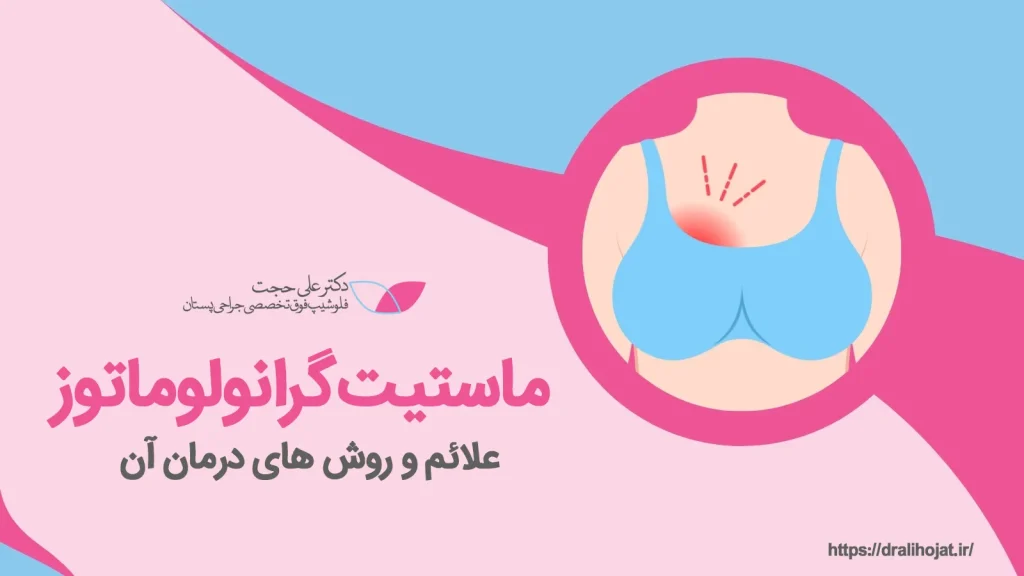 روماتیسم پستان