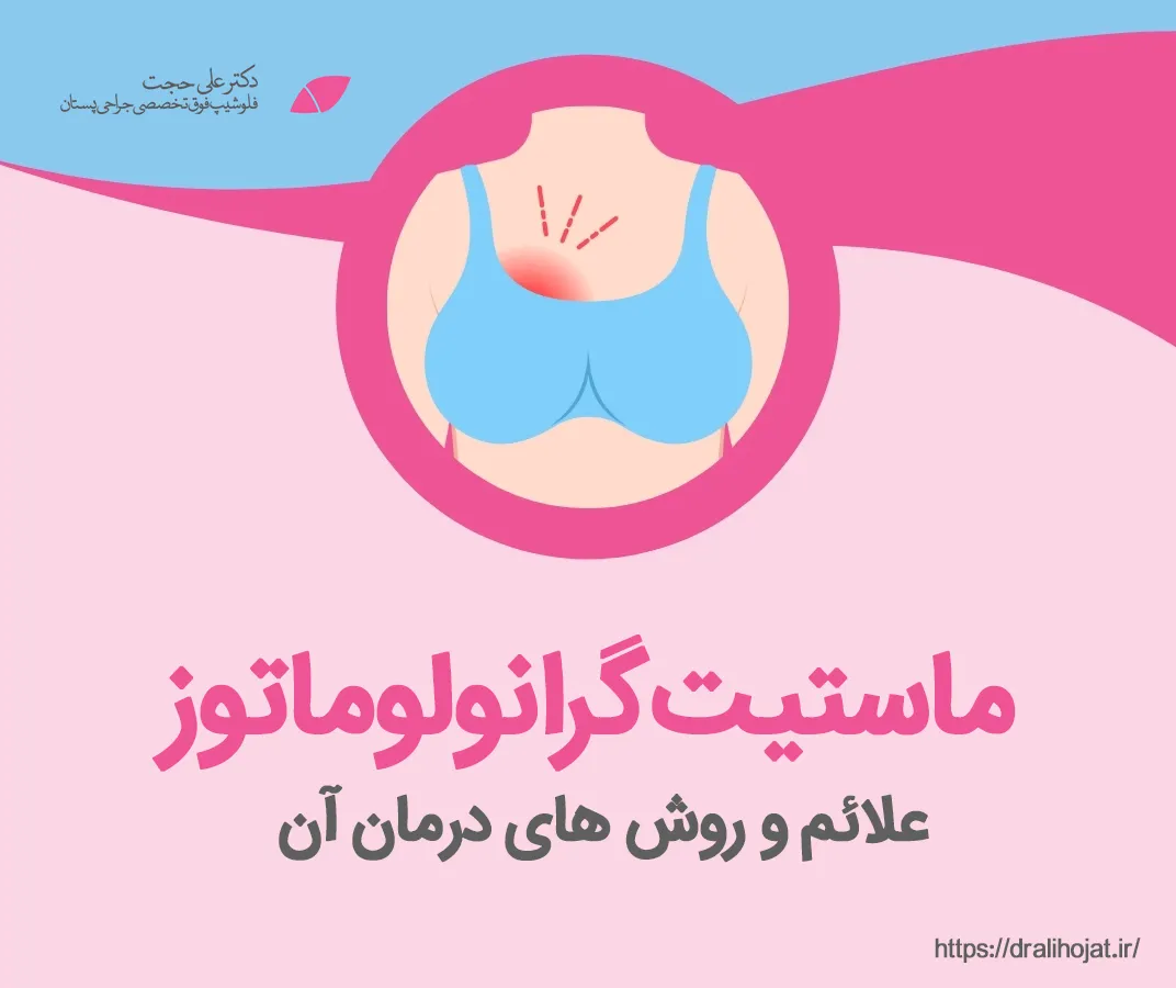 ماستیت گرانولوماتوز