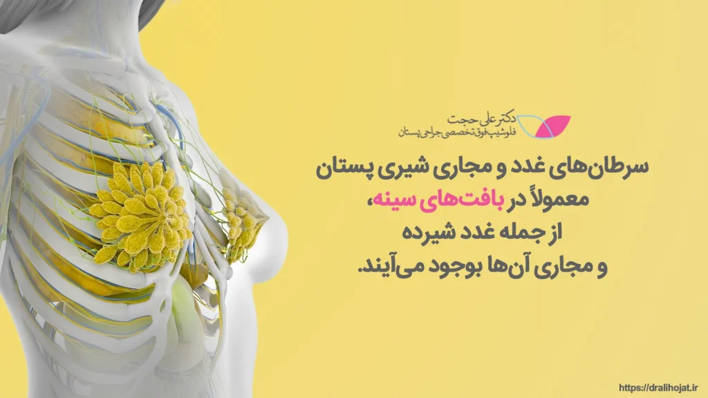 سرطان های غدد و مجاری شیری سرطان های غدد و مجاری شیری