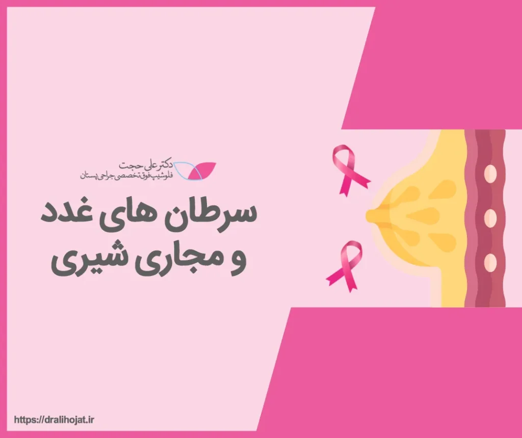 کارسینوم داکتال