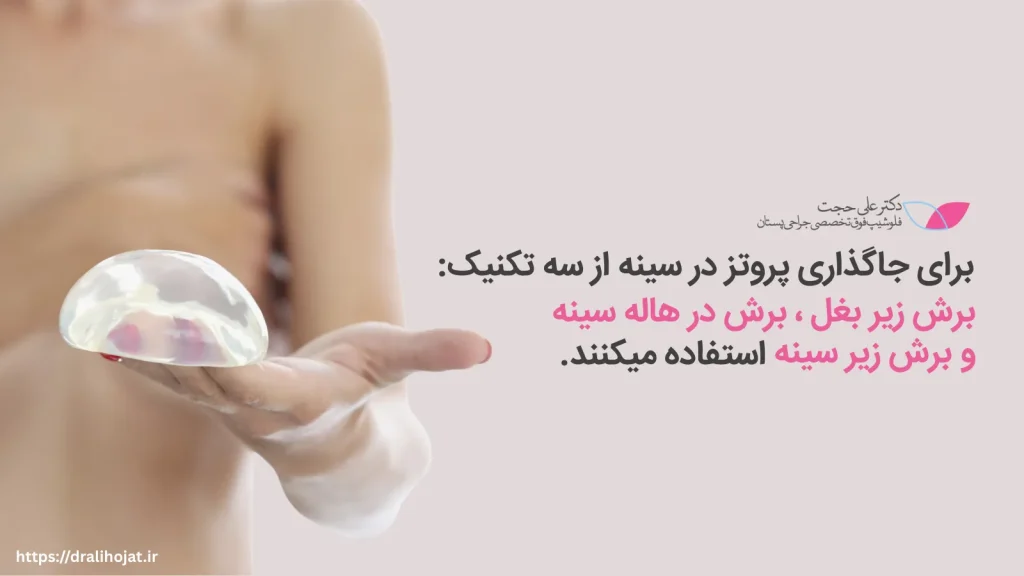 روش های جایگذاری پروتز سینه