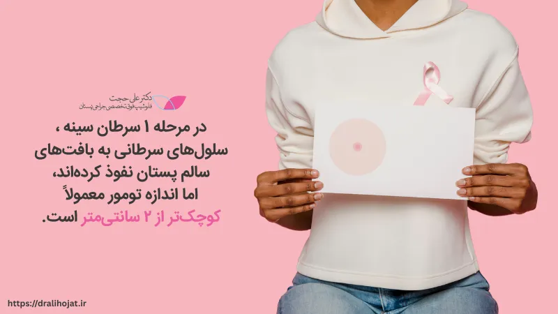 مرحله ۱ سرطان سینه