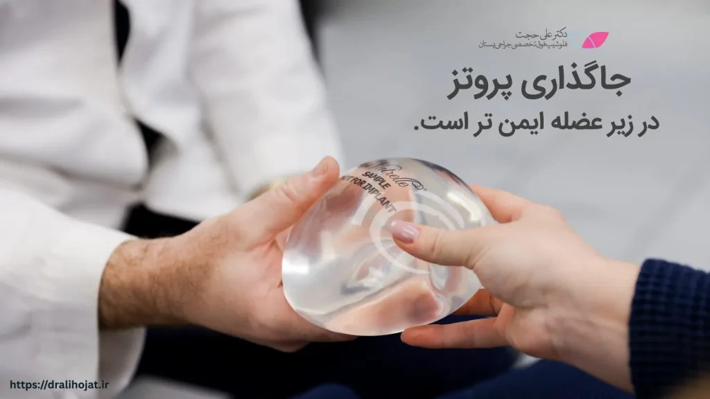 پروتز سینه زیر عضله